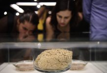 Control de hipertensión y diabetes, fundamental en prevención de enfermedad vascular cerebral
