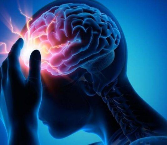 Fundamental actuar antes de 4.5 horas ante un accidente cerebro vascular